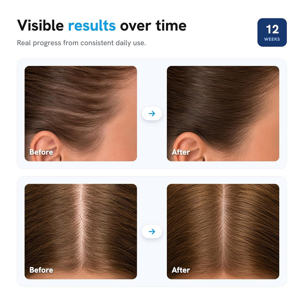 Daily Ritual for Healthier-Looking Hairlines.