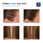 Daily Ritual for Healthier-Looking Hairlines.
