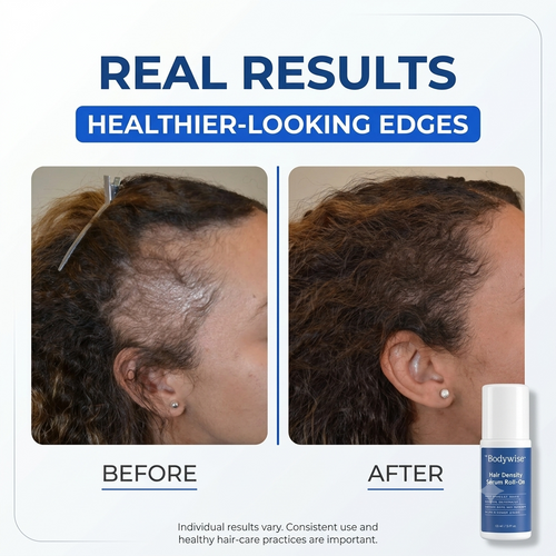 Daily Ritual for Healthier-Looking Hairlines.